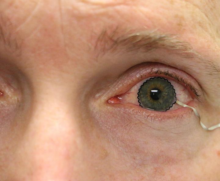 Purdue Contact Lens Technology