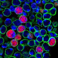 Quiescent Neural Stem Cells in the Brain
