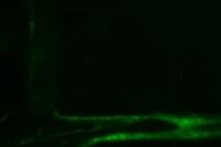 Vessels Clotting