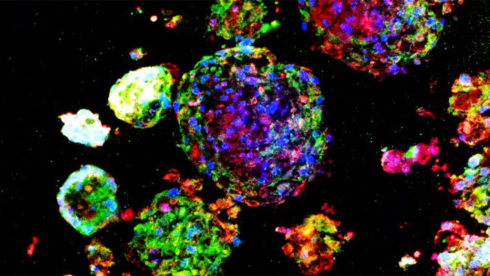 Lung Spheroid