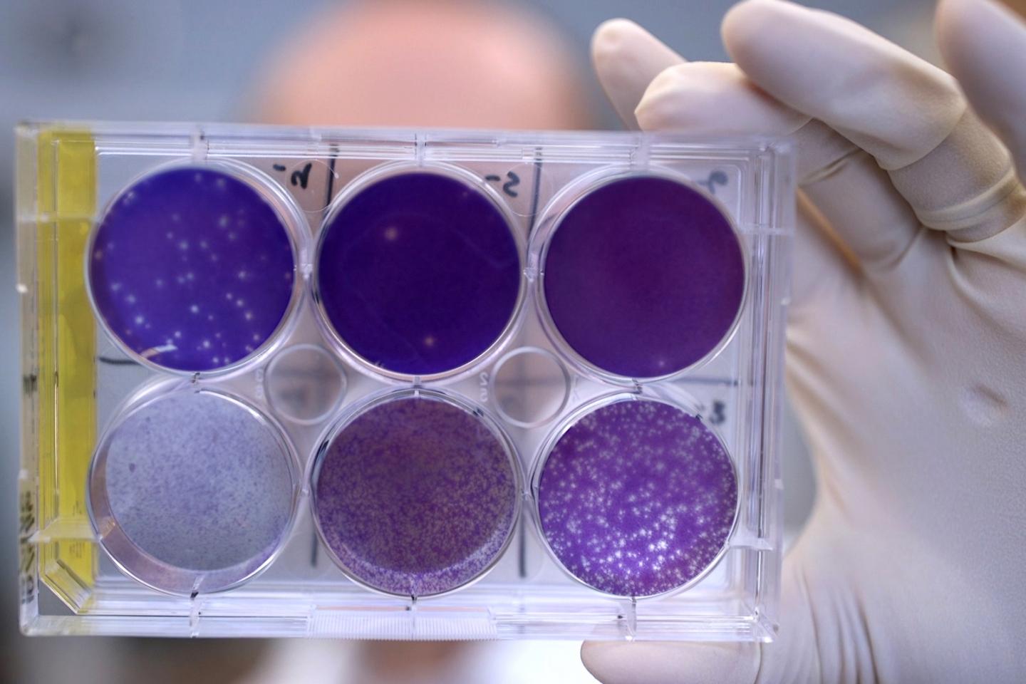 Antibodies Protect Fetuses against Zika