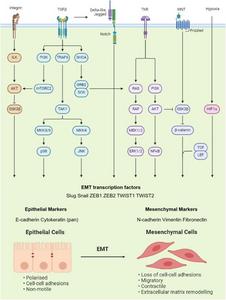 Diagram illustrating the epithelial-mesenchymal transition (EMT)-associated signaling pathways involved in the proliferation, invasion, and stemness of glioblastoma (GBM) cells.