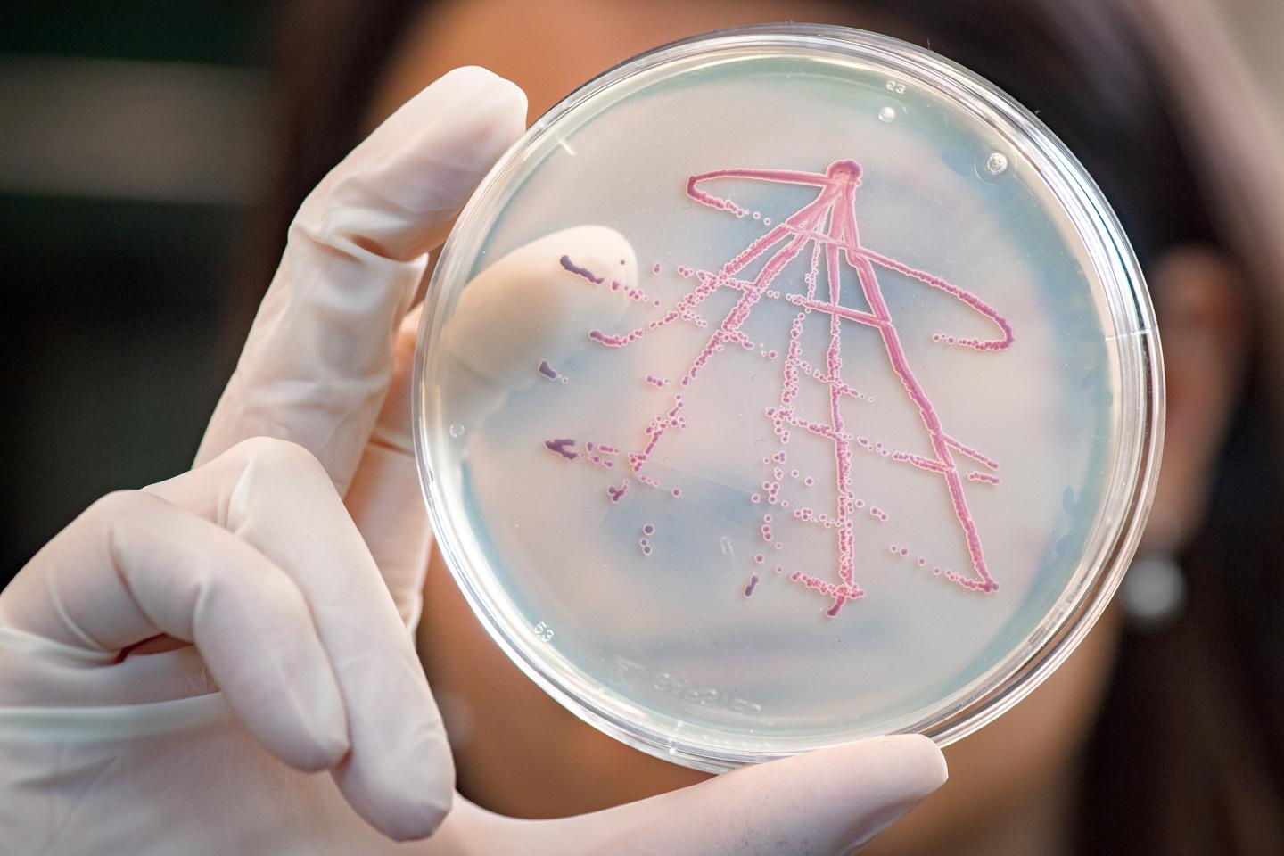 Bacterial Culture