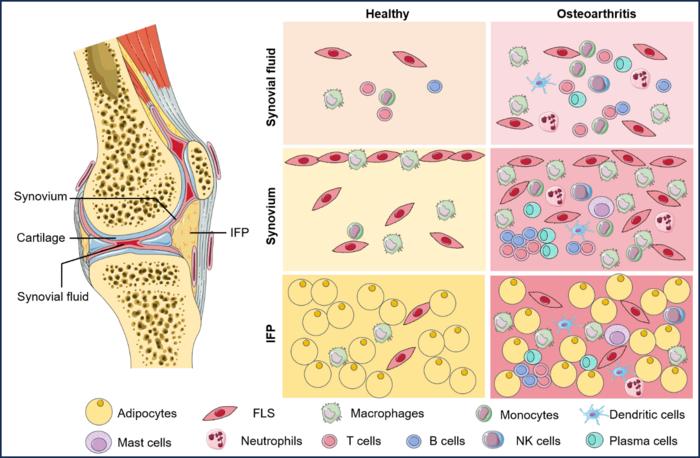 Immune cells in the synovial, synovium, and infrapatellar fat pad in health and osteoarthritis