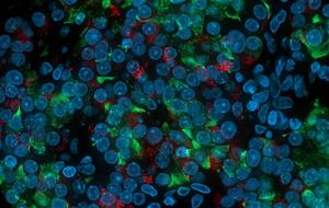 Stem cell derived islets stained for glucagon and insulin