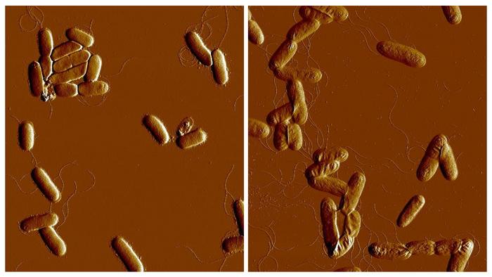 Yersinia pseudotuberculosis