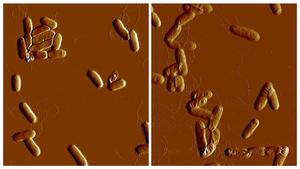 Yersinia pseudotuberculosis