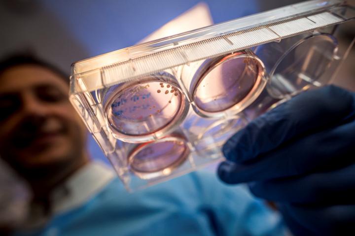 Brain Organoids