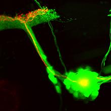 Repairing Neurons
