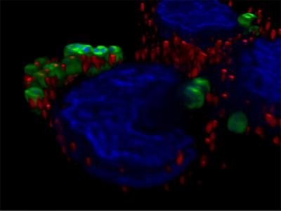 Group B Streptococcus