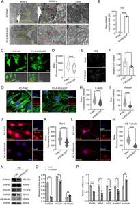 P-PDE4DIP has abnormal skeleton, polarity, and mitochondria in primary cardiomyocytes of neonatal Sprague–Dawley rats within 3 days of birth (PC), compared with the P-NC.