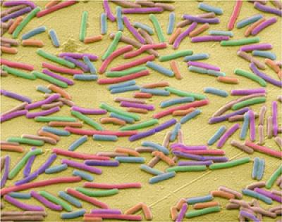 <i>E. coli</i>