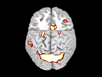 Brain Scan of Active Areas