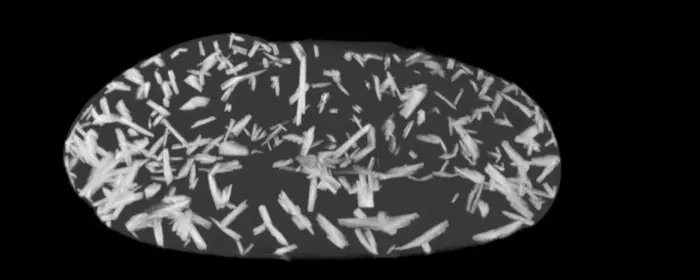 X-ray computed tomography reveal delicate frostlike structures in  Gallium