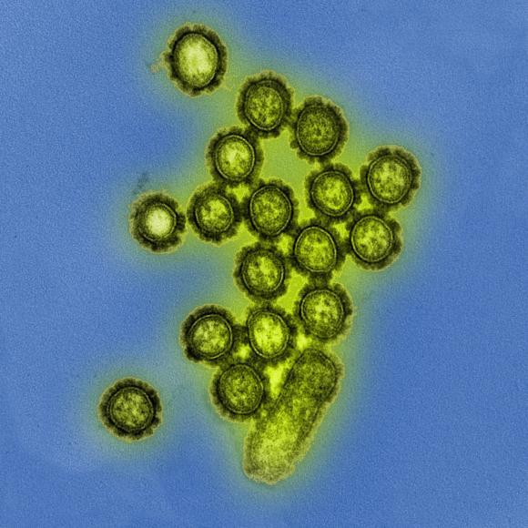 The H1N1 Flu