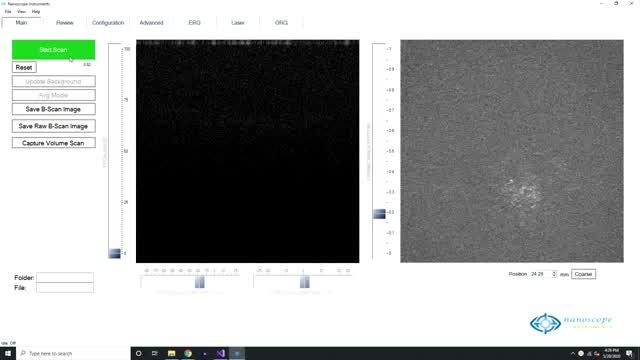 OCT Guided 3D Structural Imaging 