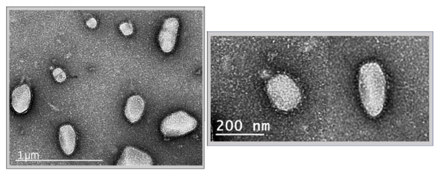 Electron Microscopy (EM) Images of SARS-CoV-2 Virus-like Particles