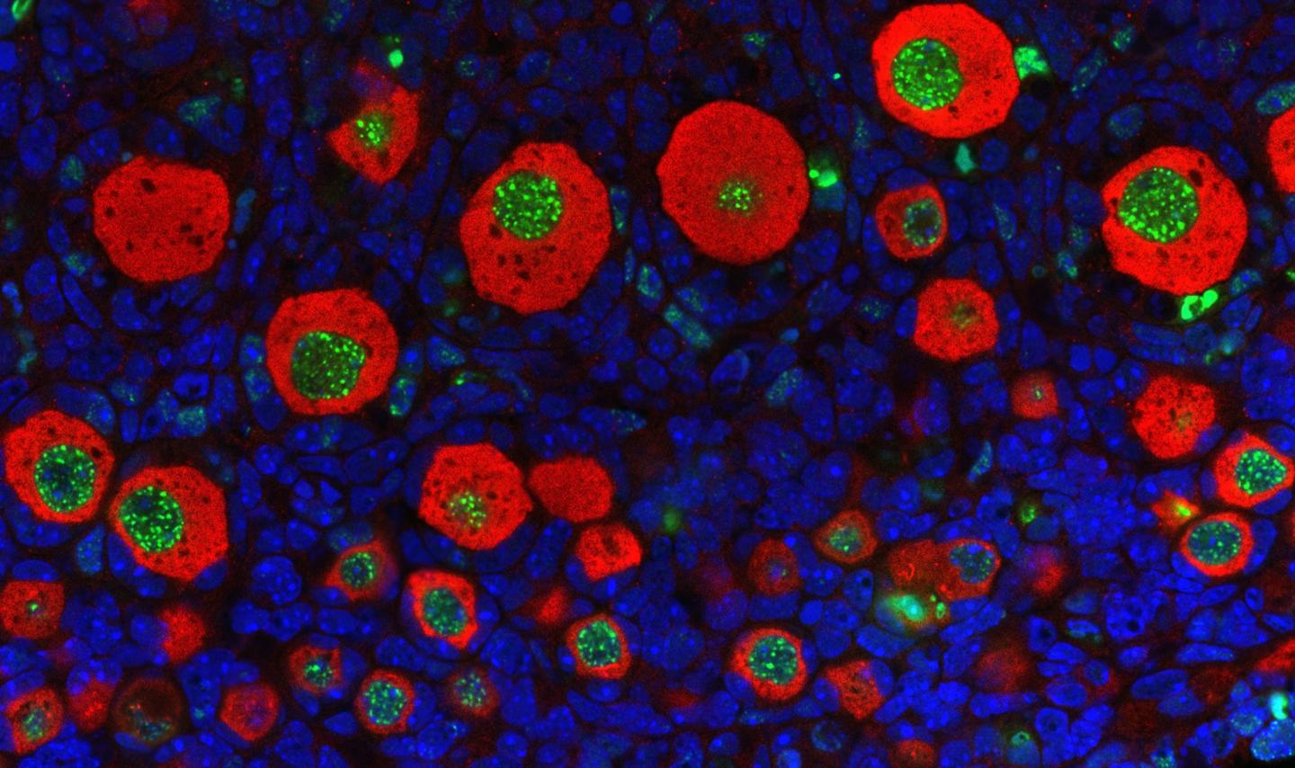 DNA Damage in Mouse Ovary Treated with Cisplatin