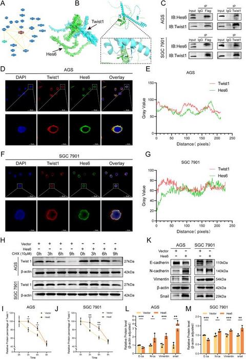Hes6 binds to Twist1 and maintains the stability of Twist1, promoting epithelial-mesenchymal transition (EMT) of GC cells
