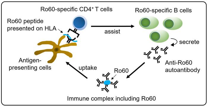 Proposed model of a self-reinforcing autoimmune loop in Sjögren’s disease