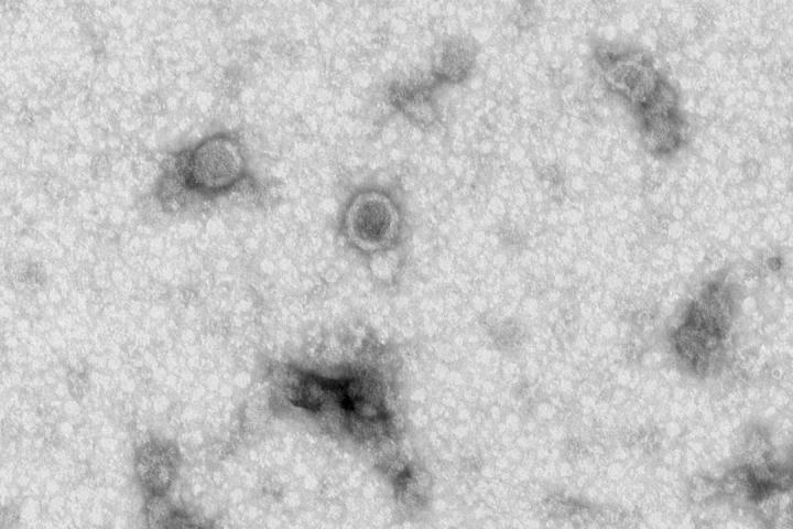 Exosomes, Jerrold Olefsky, UC San Diego School of Medicine