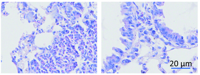 KQS-1 reduces inflammation in asthmatic mice