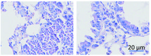 KQS-1 reduces inflammation in asthmatic mice