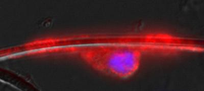 Nerve Cell + Fiber