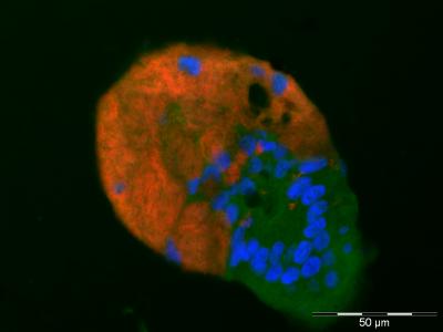 How Beetles Keep Bacteria in Check (7 of 15)