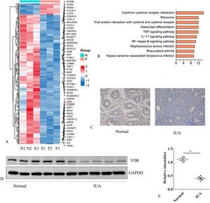 VDR expression is reduced in the endometrial tissue of patients with IUA compared to normal endometrial tissue.