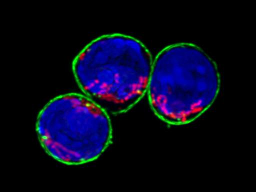 Microscopic Image of Th17 Cells in a Healthy Gut