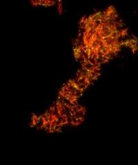 Amyloid Fibrils in Semen