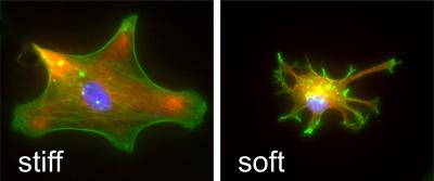 Astrocyte