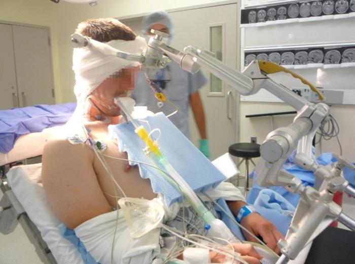 Awake Craniotomy and Intraoperative Brain Mapping
