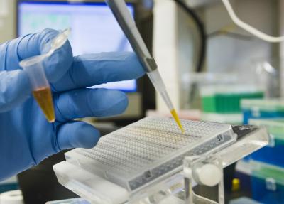 Diabetes Research in Michael Schwartz's University of Washington Lab