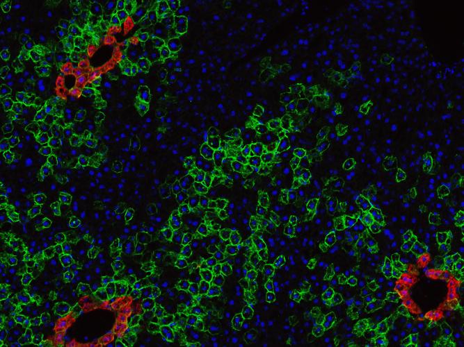 Liver Stem Cells