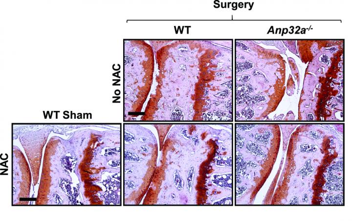 Antioxidant Defender Protects Against Osteoarthritis (1 of 1)