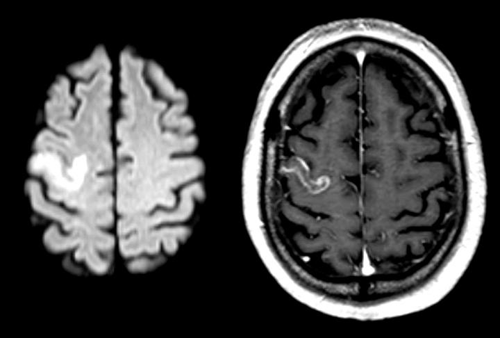 Brain Image