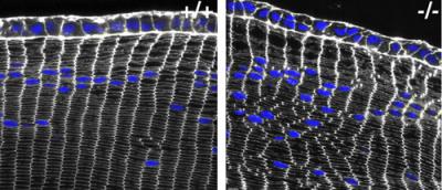 Arrangement of Lens Fiber Cells