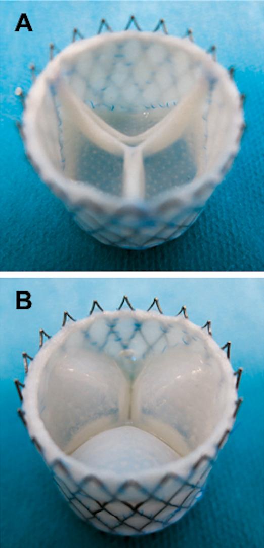Growing Life-Like Heart Valves, Thanks to Help from Computational Modeling (1 of 3)