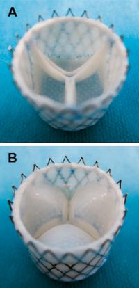 Growing Life-Like Heart Valves, Thanks to Help from Computational Modeling (1 of 3)