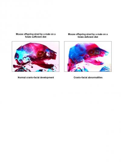 Folate and Neo-Cranial Development in Mice