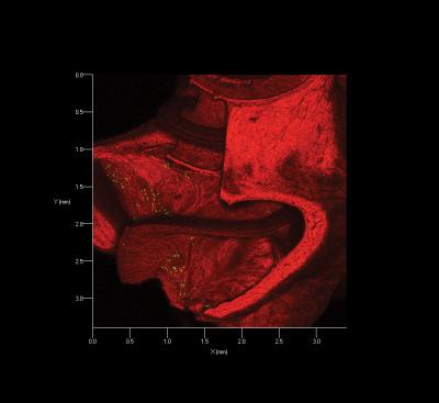 Cochlear Implant Gets an Upgrade with Gene Therapy (1 of 10)