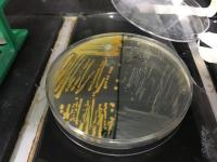 <em>S. Aureus</em> Wild Type and SCVs