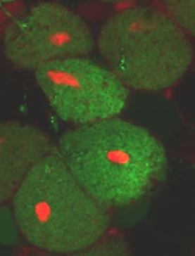 Rhizobia
