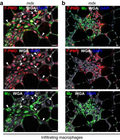 PMO Penetrates Infiltrating Inflammatory Cells Targeting Regions of Active Muscle Regeneration