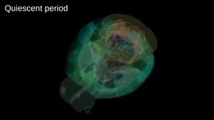 Whole-brain neural activity across decision-making stages in mice