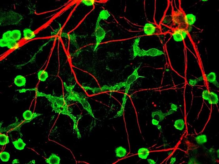 Fluorescence microscopy of microglia and neurons