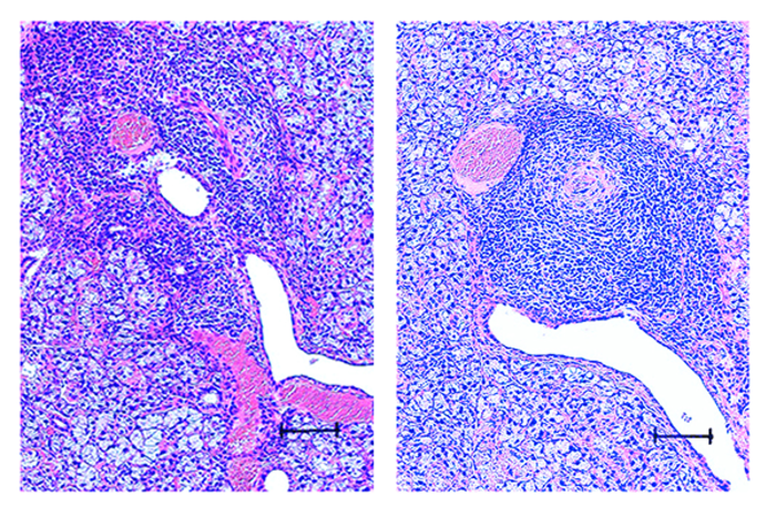 New Spontaneous Mouse Model Shows Promise for Bolstering Sjögren's Syndrome Treatment