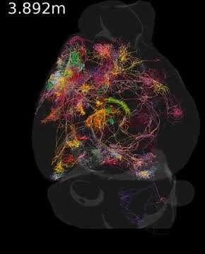 Brain Filling Larger Counter